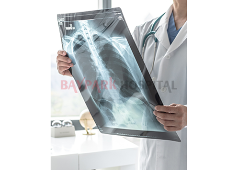 KOAH (Kronik obstrüktif akciğer hastalığı) Nedir?